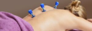Magnetic cupping 